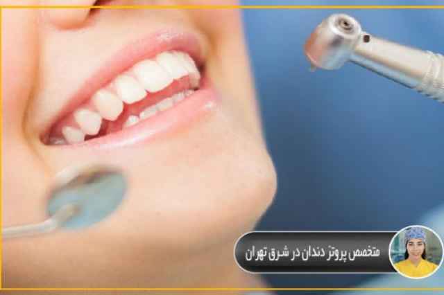متخصص پروتز دندان در شرق تهران