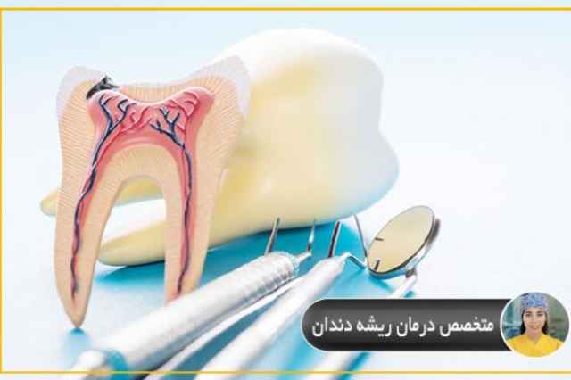 متخصص درمان ريشه دندان